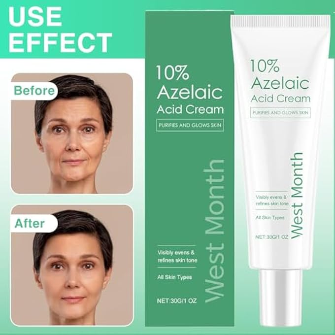 WEST MONTH AZELAIC ACID SERUM 10%, FACE CREAM FOR ALL SKIN TYPES, DARK SPOT AND ACNE TREATMENT, FACE SERUM FOR UNEVEN SKIN TONE, REDNESS RELIEF, BLEMISH-PRONE SKIN,30G - Image 4